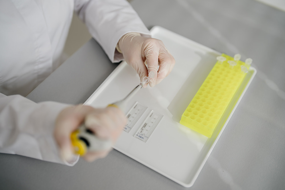 PCR Pilz-Diagnostik