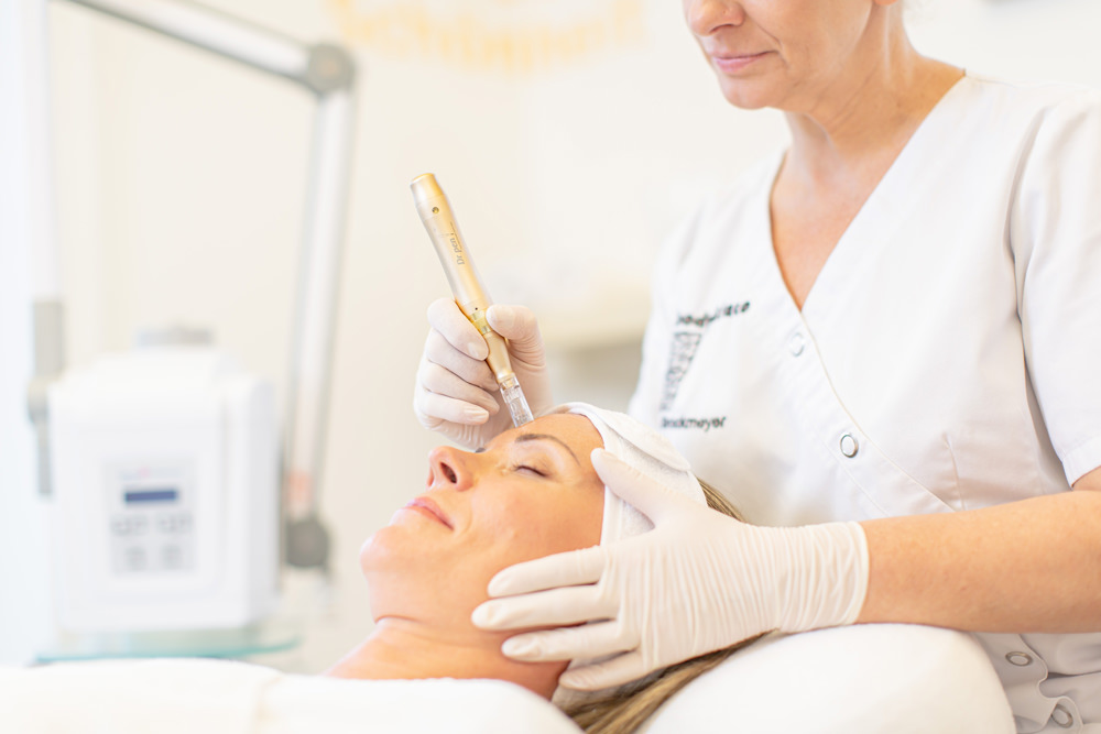 Hautarzt Stolzenau und Neustadt – Dr. med. Torsten Opitz – Microneedling Hautarzt Stolzenau und Neustadt - Dr. med. Torsten Opitz - Microneedling